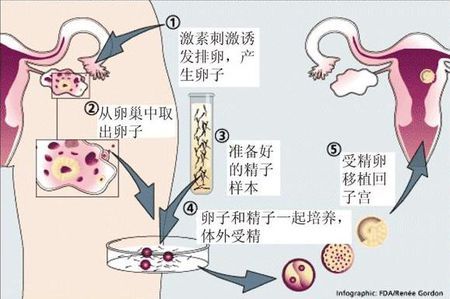代生男孩包性别